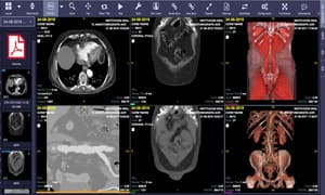 VisualMedica - Cloud PACS Demo3