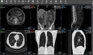 VisualMedica - Cloud PACS Demo4