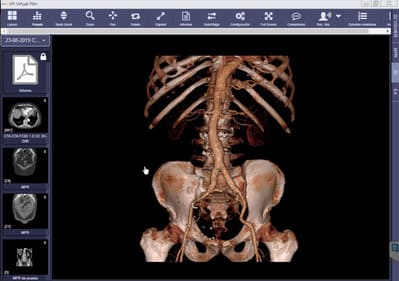 VisualMedica Reconstrucción MPR 3D