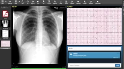 VisualMedica Cloud PACS - Archivos complementarios